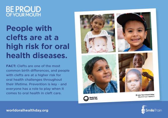Key Message card Oral Health and Cleft Care 